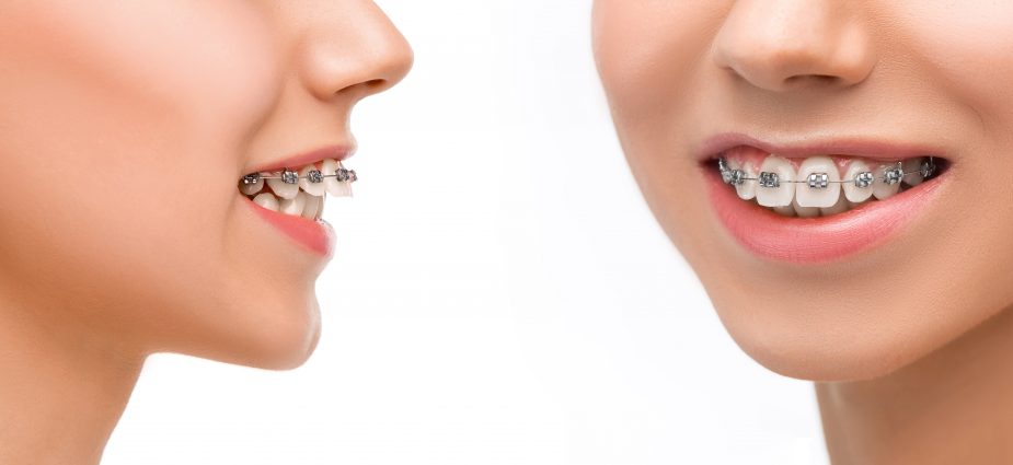 Orthodontic Solutions